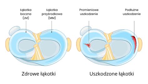 Przykładowe uszkodzenie wylewki zewnętrznej