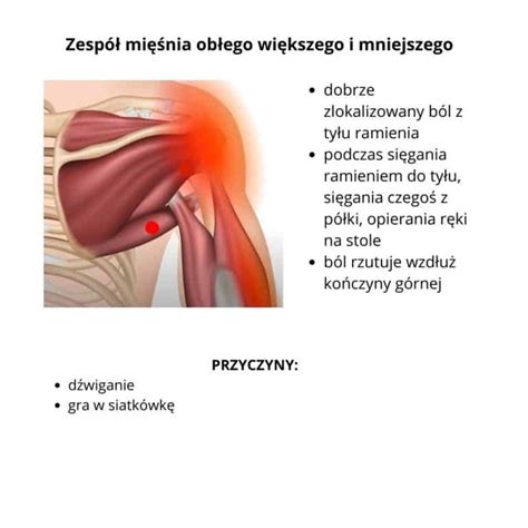 Schemat anatomiczny mięśnia zębatego przedniego z zaznaczonymi przyczepami